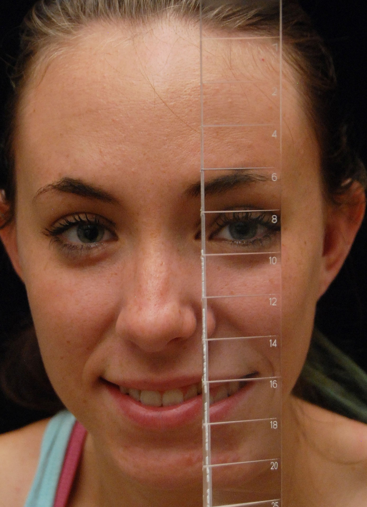 EZ View Prism Bars Gulden Ophthalmics